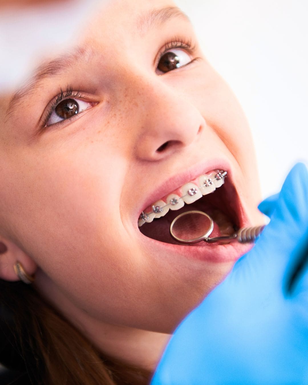 Qué es la ortodoncia